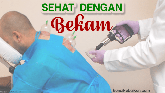 sehat dengan bekam